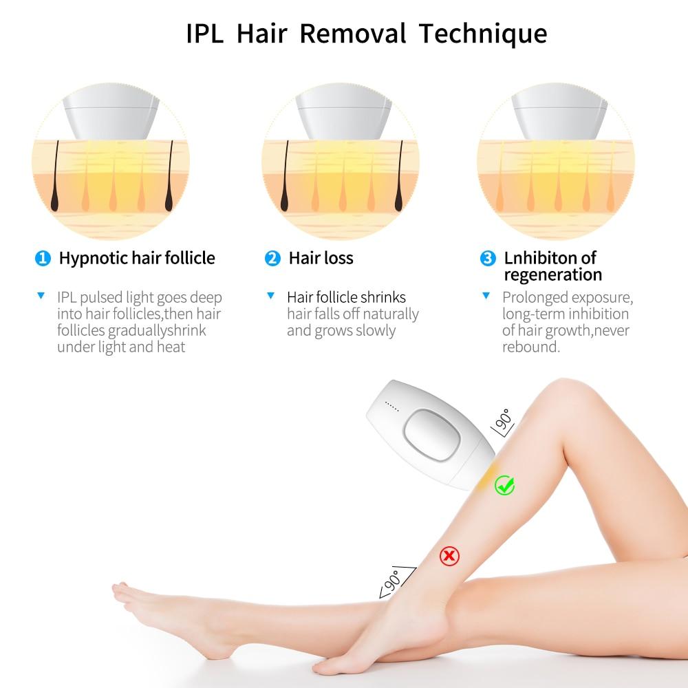 Forever Smooth - IPL Hair Removal - Client451